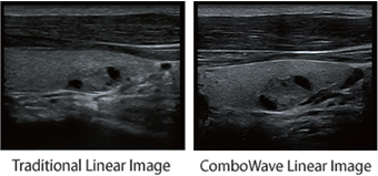 Combo Wave transducers