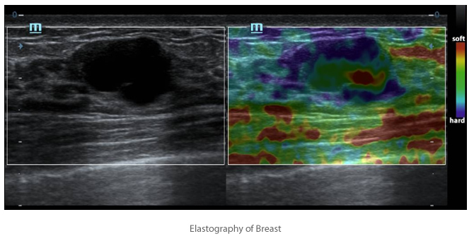 Natural Touch Elastography