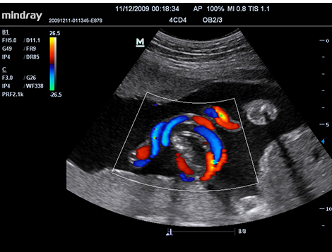 DC-60 DC T6 Ultrasound System
