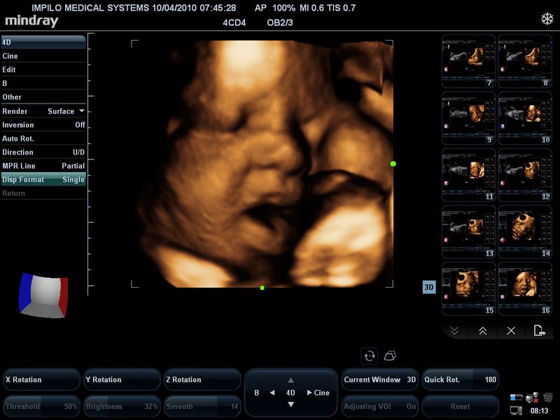 4D imaging