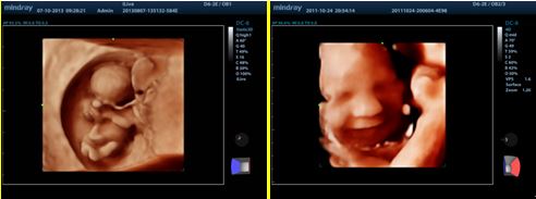3D/4D Imaging