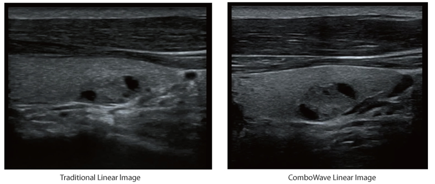 DC-60 EXP X-Insight Ultrasound India