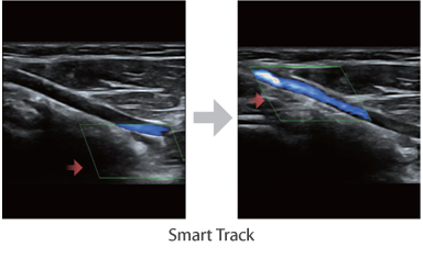 eXceptional Intelligence