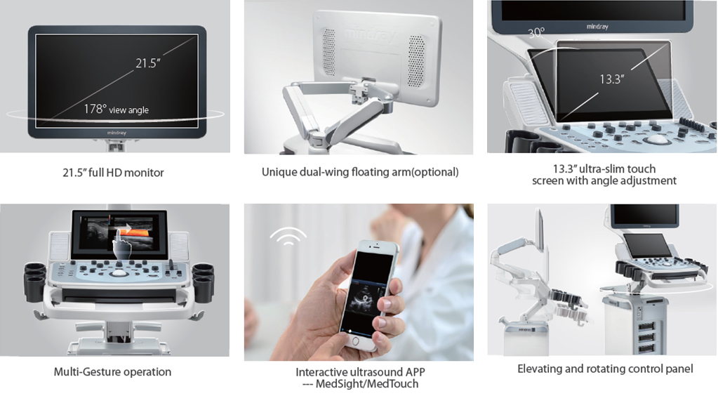 eXceeding Experience