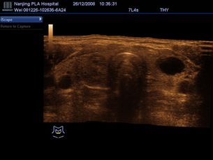 Real-time Panoramic Imaging