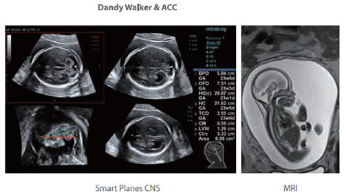 Smart Planes CNS