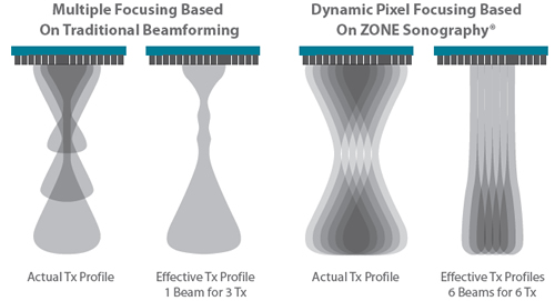 Dynamic Pixel Focusing