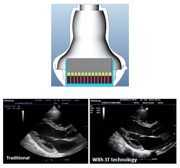 3T Transducer Technology