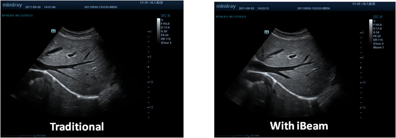 iClear (Need application specific images)
