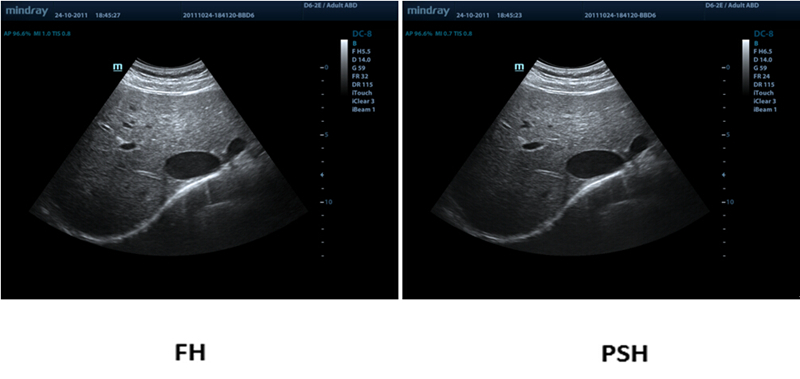 Phase Shift Harmonic Imaging